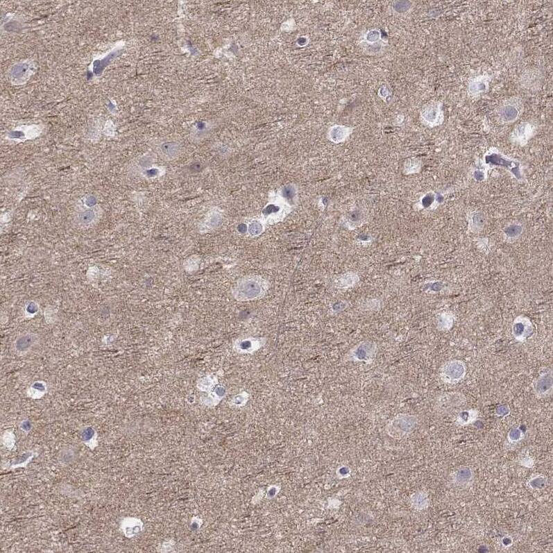 Staining of human cerebral cortex shows moderate positivity in neuropil.