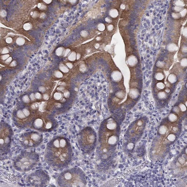 Staining of human duodenum shows moderate cytoplasmic/ membranous positivity in glandular cells.