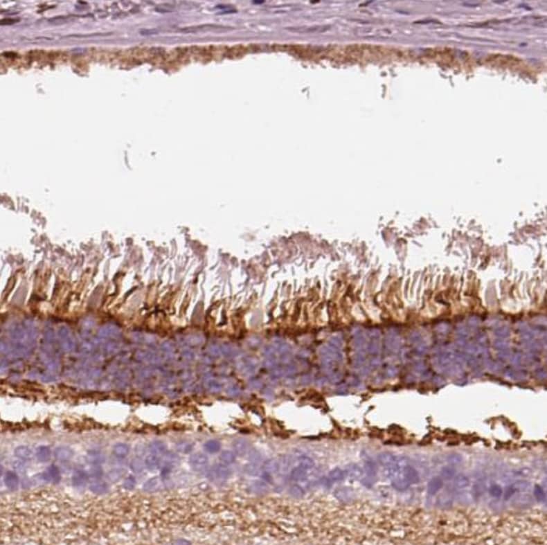 Staining of human eye shows strong positivity in retina.