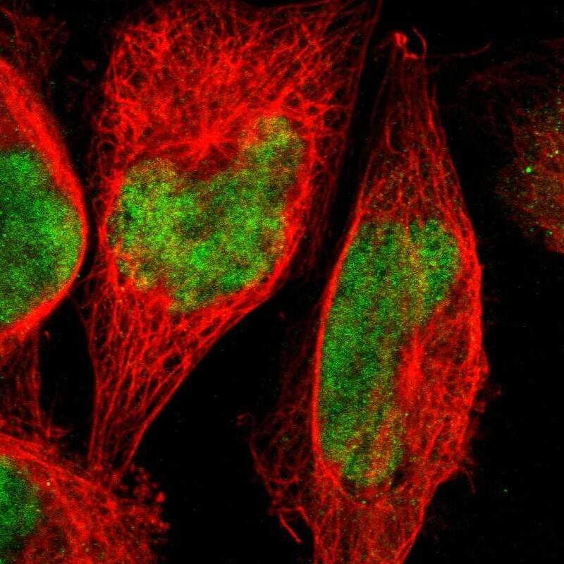 Staining of human cell line A-431 shows localization to nucleoplasm.