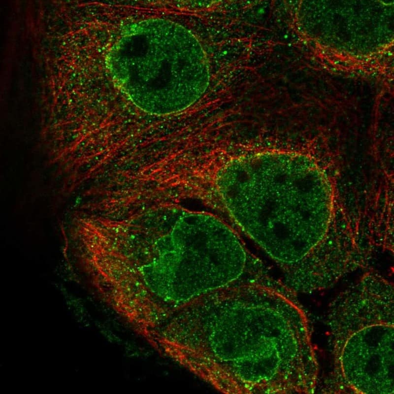 Staining of human cell line CACO-2 shows localization to nucleoplasm, nuclear membrane & vesicles.
