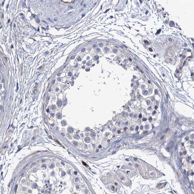 Staining of human testis shows no membranous positivity in cells in seminiferous ducts as expected.