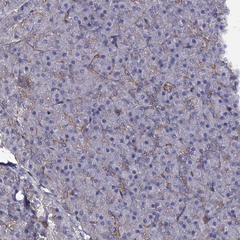 Staining of human pancreas shows moderate membranous positivity in exocrine glandular cells.