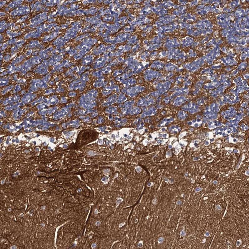 Staining of human cerebellum shows strong positivity in neuronal processes.