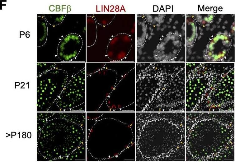 Expression of Cbfb throughout postnatal germline development. (A–D) Analysis of published scRNA-seq data from the postnatal germline development. Uniform manifold approximation projection (UMAP) representation of Cbfb transcripts (A) and germ cell subtypes (B) in the adult (P56) germline. Also, violin plots of Cbfb transcript abundance within germ cell subtypes (C) and spermatogonia through postnatal development (D) are included. (E) Representative images of immunofluorescence staining using an antibody recognizing CBF beta  (green) and DAPI (grey) from testis cross-sections of adult wild-type mice. (F–I) Representative images from co-immunofluorescence staining for CBF beta  (green) and select spermatogonia markers within the postnatal testis, including LIN28A [(F) undifferentiated spermatogonia], cKIT [(G) differentiating spermatogonia], GFR⍺1 [(H) SSC-enriched spermatogonia], and SOX3 [(I) progenitor-enriched spermatogonia]. White arrowhead identifies CBF beta + cells. Yellow arrowhead identifies CBF beta -cell. Scale bar is 50 um for images in (E–I). Image collected and cropped by CiteAb from the following open publication (//pubmed.ncbi.nlm.nih.gov/38020932), licensed under a CC-BY license. Not internally tested by Novus Biologicals.