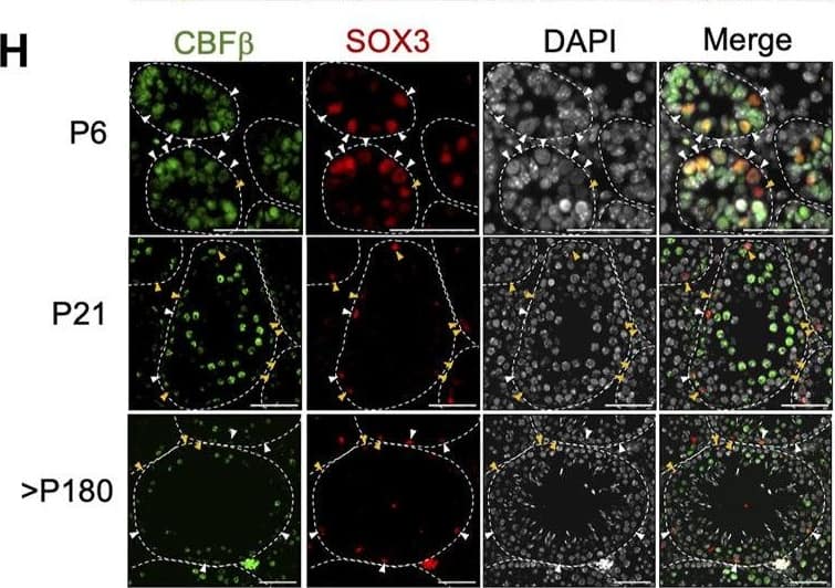 Expression of Cbfb throughout postnatal germline development. (A–D) Analysis of published scRNA-seq data from the postnatal germline development. Uniform manifold approximation projection (UMAP) representation of Cbfb transcripts (A) and germ cell subtypes (B) in the adult (P56) germline. Also, violin plots of Cbfb transcript abundance within germ cell subtypes (C) and spermatogonia through postnatal development (D) are included. (E) Representative images of immunofluorescence staining using an antibody recognizing CBF beta  (green) and DAPI (grey) from testis cross-sections of adult wild-type mice. (F–I) Representative images from co-immunofluorescence staining for CBF beta  (green) and select spermatogonia markers within the postnatal testis, including LIN28A [(F) undifferentiated spermatogonia], cKIT [(G) differentiating spermatogonia], GFR⍺1 [(H) SSC-enriched spermatogonia], and SOX3 [(I) progenitor-enriched spermatogonia]. White arrowhead identifies CBF beta + cells. Yellow arrowhead identifies CBF beta -cell. Scale bar is 50 um for images in (E–I). Image collected and cropped by CiteAb from the following open publication (//pubmed.ncbi.nlm.nih.gov/38020932), licensed under a CC-BY license. Not internally tested by Novus Biologicals.