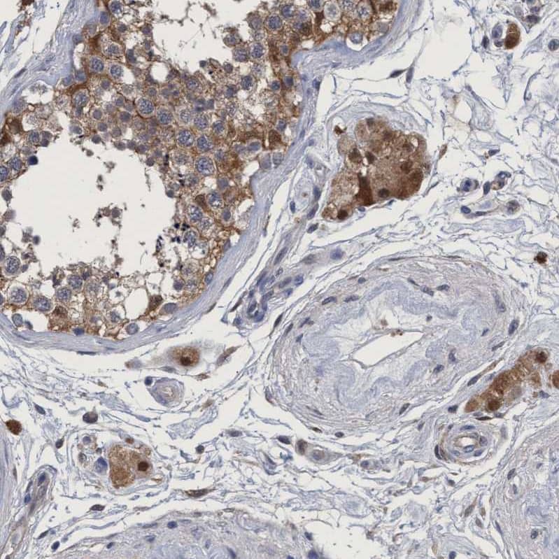 Staining of human testis shows moderate cytoplasmic-nuclear positivity in Leydig cells and moderate cytoplasmic positivity in cells in seminiferous ducts.