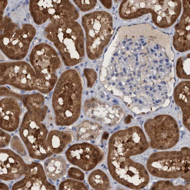 Staining of human kidney shows strong cytoplasmic positivity in cells in tubules.