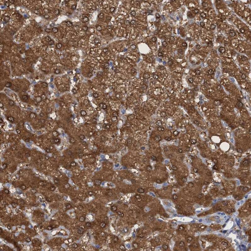 Staining of human liver shows strong cytoplasmic positivity in hepatocytes.