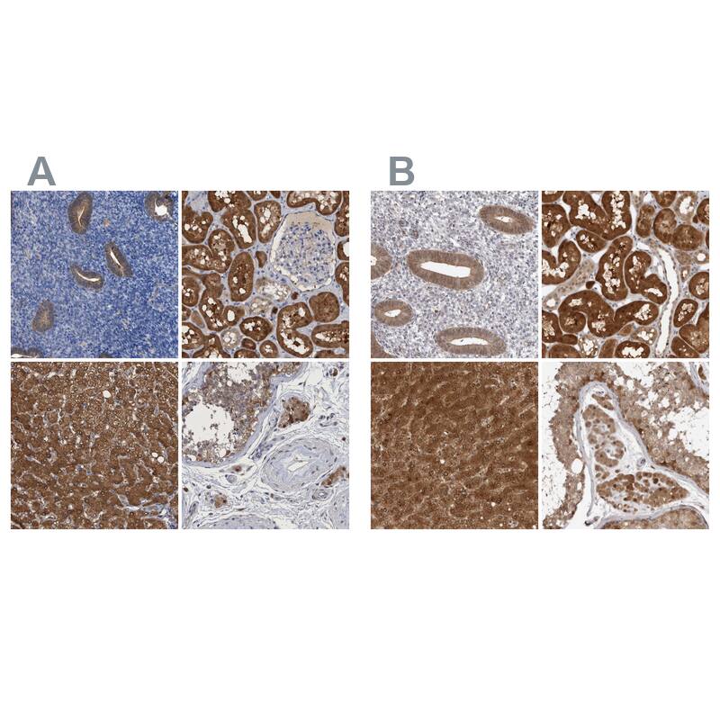 <b>Orthogonal Strategies Validation. </b>Staining of human endometrium, kidney, liver and testis HPA023204 (A) shows similar protein distribution across tissues to independent antibody HPA027776 (B).