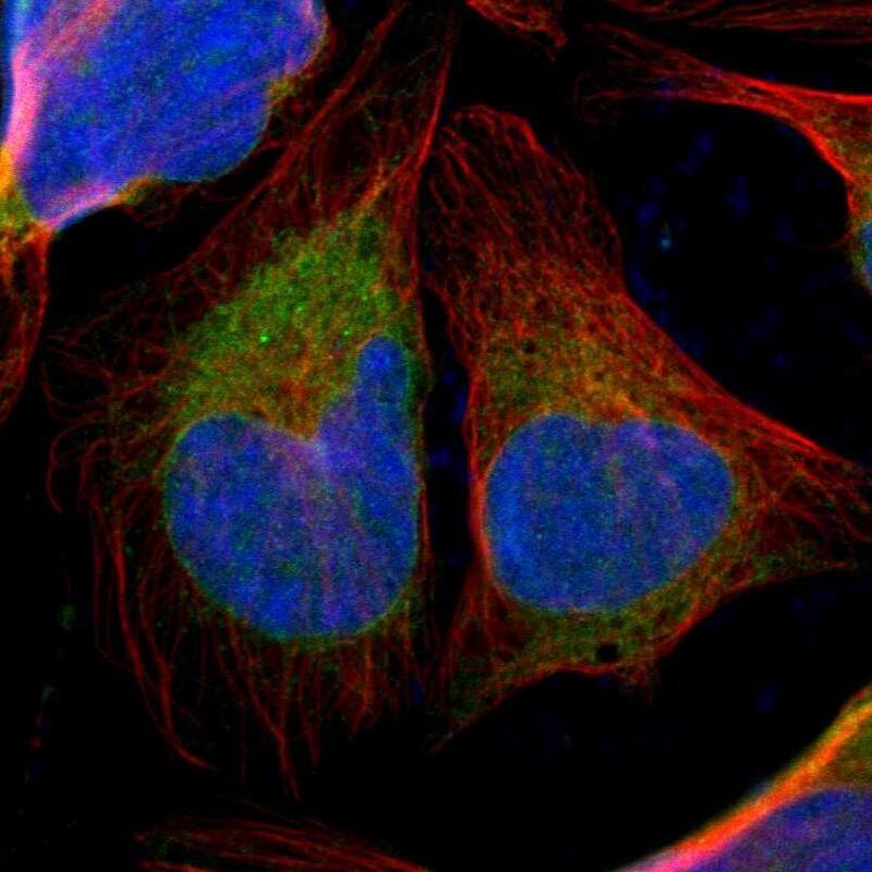 Staining of human cell line U-2 OS shows localization to nucleoli & endoplasmic reticulum.