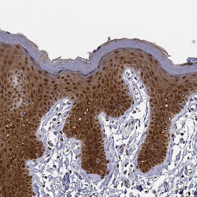 Staining of human skin shows strong cytoplasmic positivity in squamous epithelial cells.
