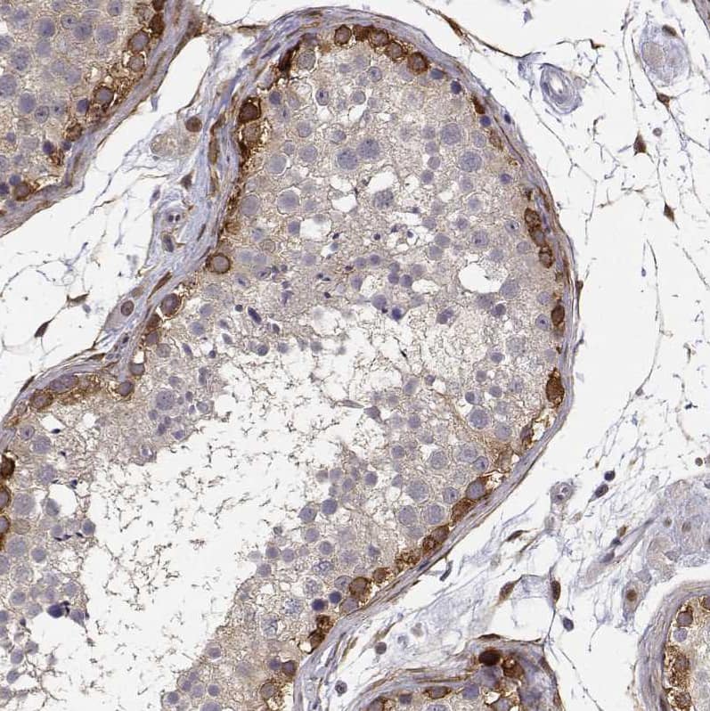 Staining of human testis shows strong cytoplasmic positivity in cells in seminiferous ducts.