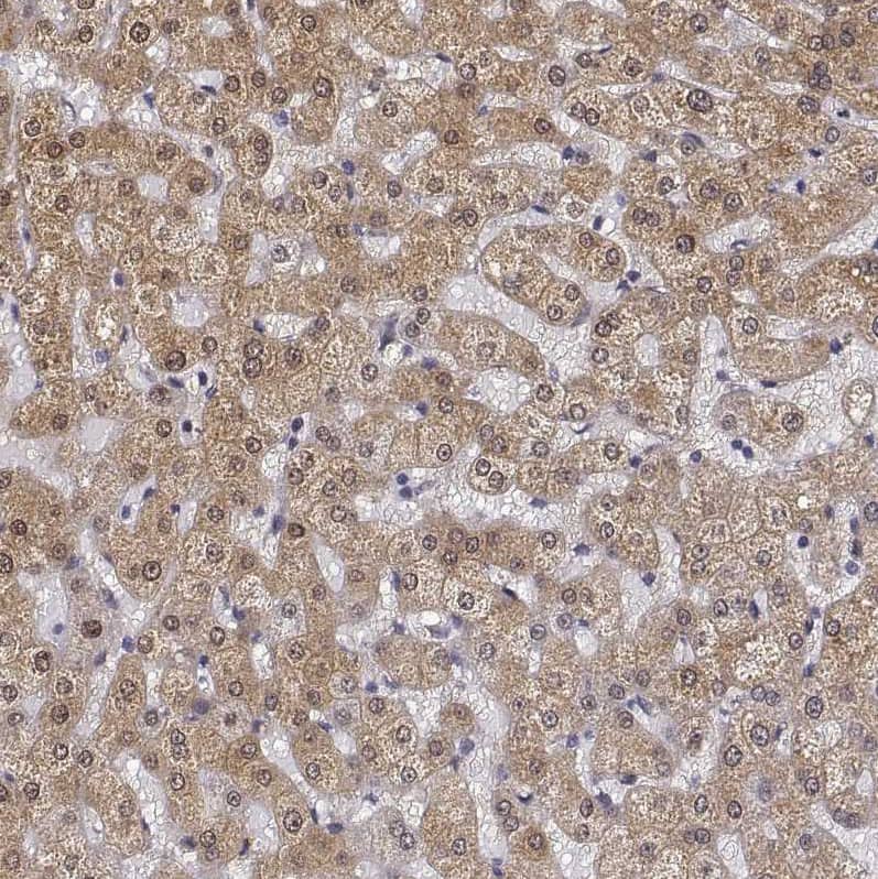 Staining of human liver shows moderate cytoplasmic positivity in hepatocytes.