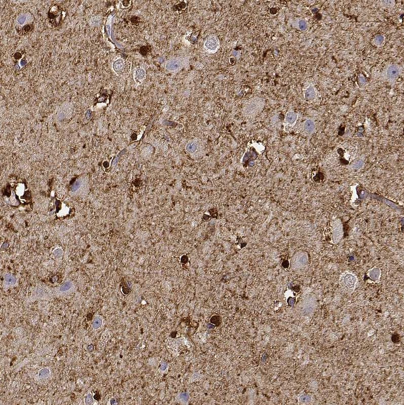 Staining of human cerebral cortex shows strong cytoplasmic positivity in glial cells.