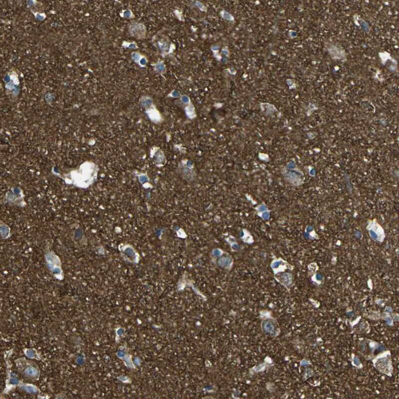 Staining of human cerebral cortex shows moderate to strong cytoplasmic positivity in neuropil.