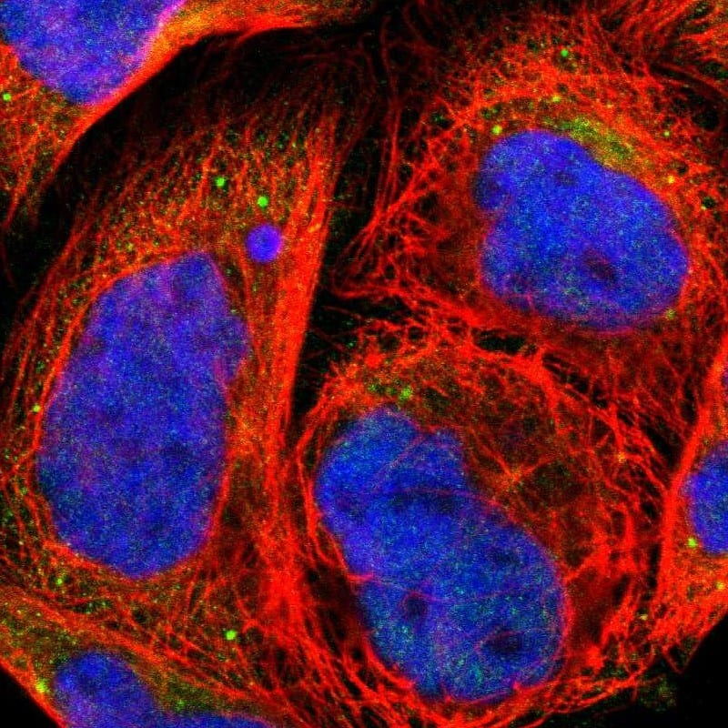 Staining of human cell line A-431 shows localization to endoplasmic reticulum & lysosomes.