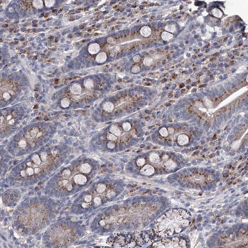 Staining of human duodenum shows high expression.