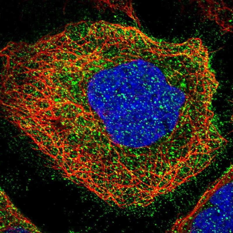 Staining of human cell line A-431 shows localization to plasma membrane & vesicles.