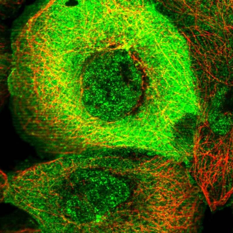 Immunocytochemistry/ Immunofluorescence PARG1 Antibody - BSA Free