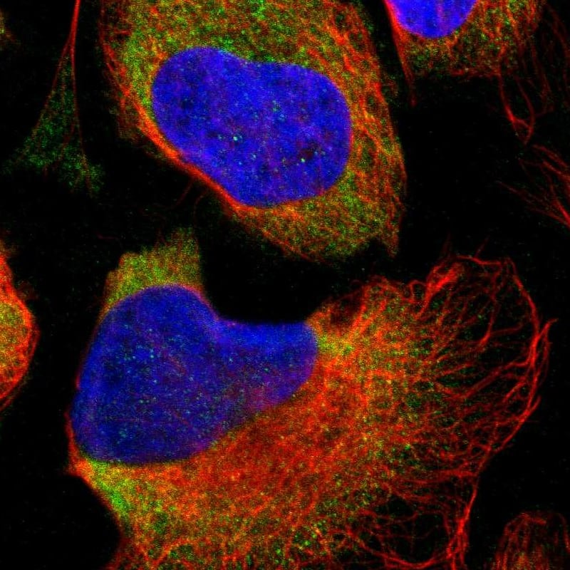 Staining of human cell line U-2 OS shows localization to cytosol.