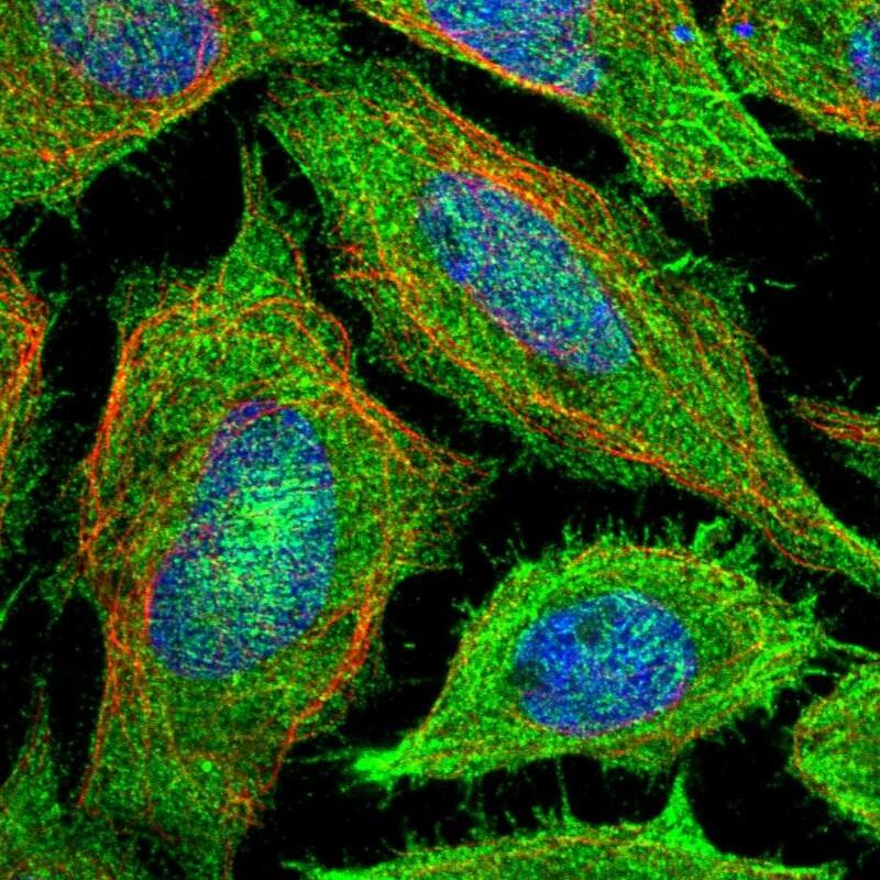 Staining of human cell line SiHa shows localization to plasma membrane & actin filaments.