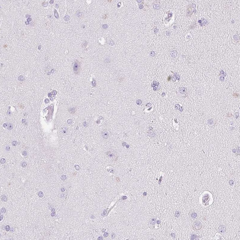 Staining of human cerebral cortex shows no positivity in neurons as expected.
