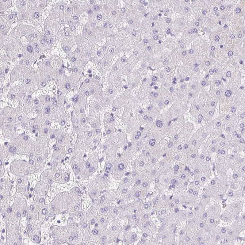 Staining of human liver shows no positivity in hepatocytes as expected.