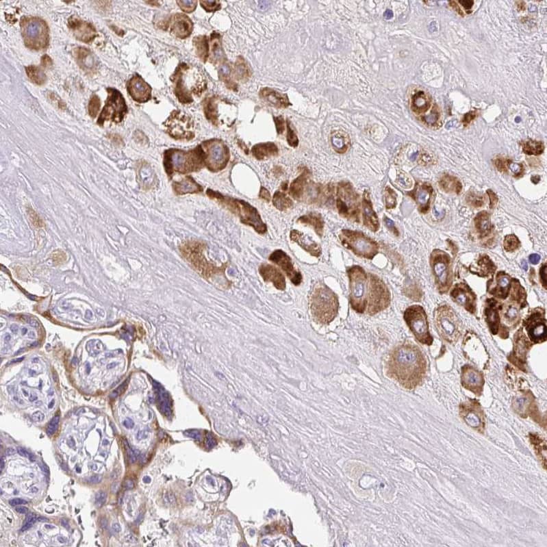 Staining of human placenta shows moderate cytoplasmic positivity in trophoblastic cells.