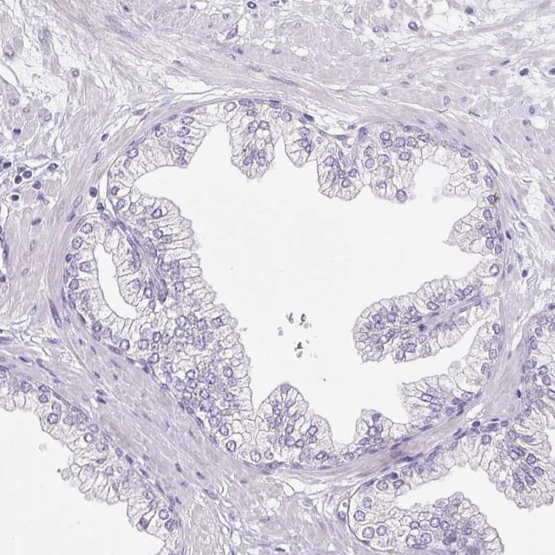 Staining of human prostate shows no positivity in glandular cells as expected.