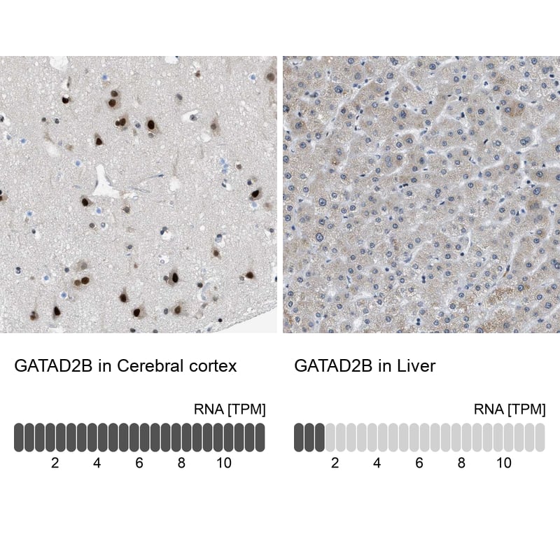 Immunohistochemistry-Paraffin p66 beta Antibody - BSA Free