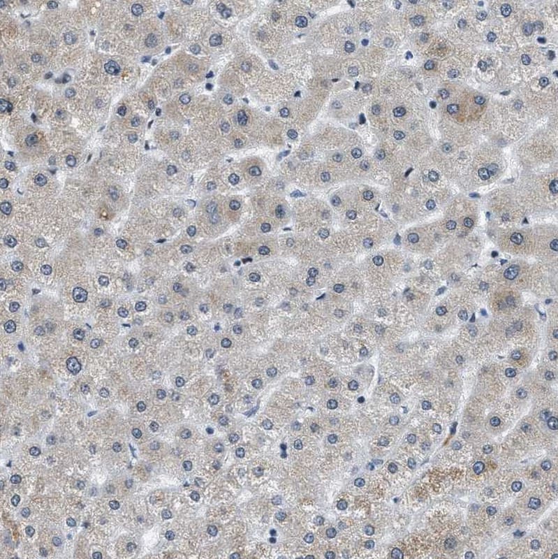 Immunohistochemistry-Paraffin p66 beta Antibody - BSA Free