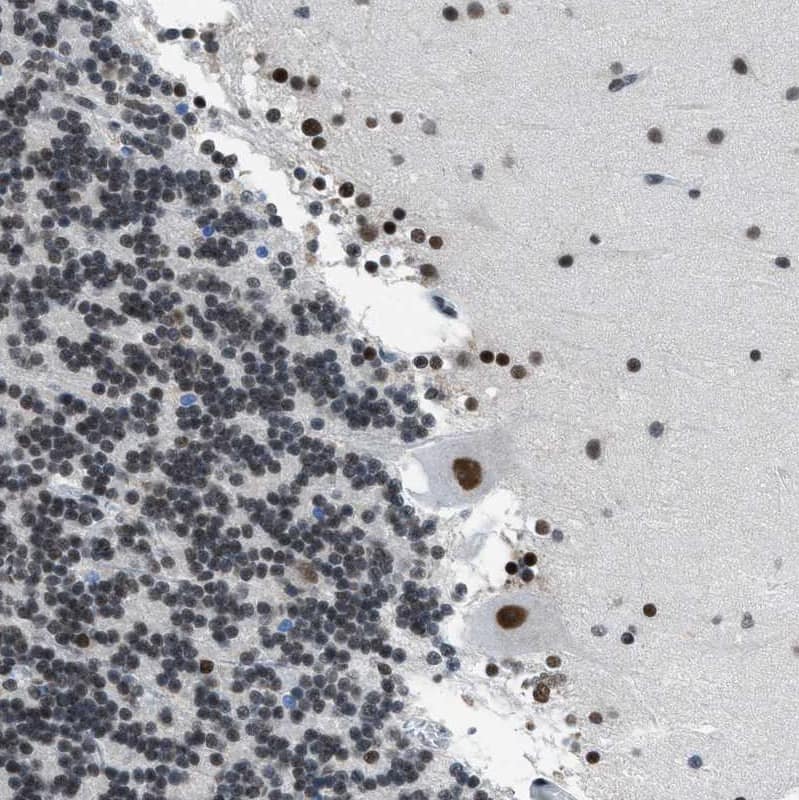 Immunohistochemistry-Paraffin p66 beta Antibody - BSA Free