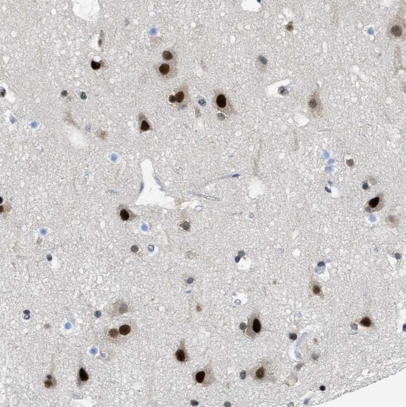Immunohistochemistry-Paraffin p66 beta Antibody - BSA Free