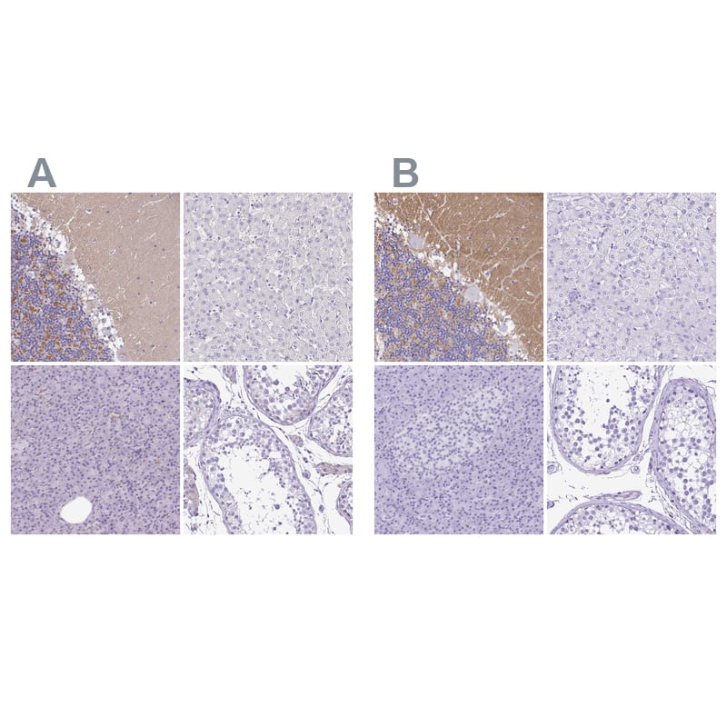 <b>Independent Antibodies Validation. </b>Staining of human cerebellum, liver, pancreas and testis using NBP1-87362 (A) shows similar protein distribution across tissues to independent antibody NBP2-34215 (B).
