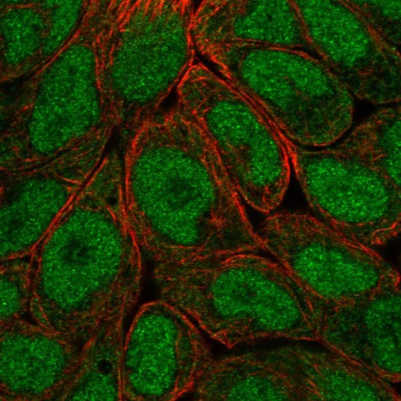 Staining of human cell line RT4 shows localization to nucleoplasm & cytosol.