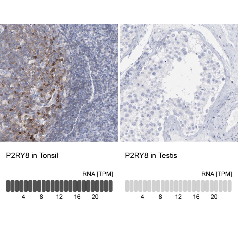 <b>Orthogonal Strategies Validation. </b>Analysis in human tonsil and testis tissues. Corresponding RNA-seq data are presented for the same tissues.