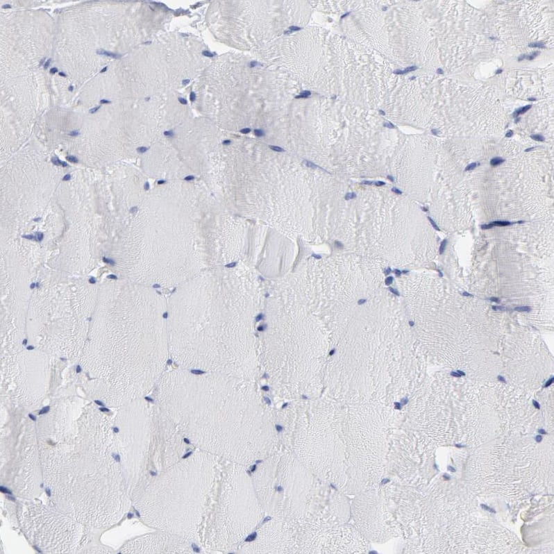 Staining of human skeletal muscle shows no membranous positivity in myocytes as expected.