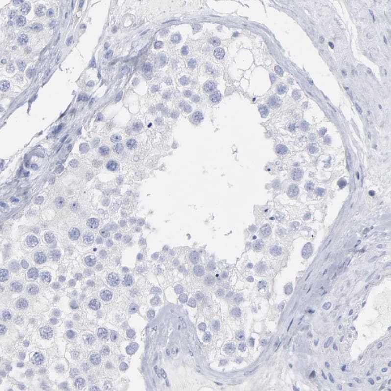 Staining of human testis shows no membranous positivity in cells in seminiferous ducts as expected.