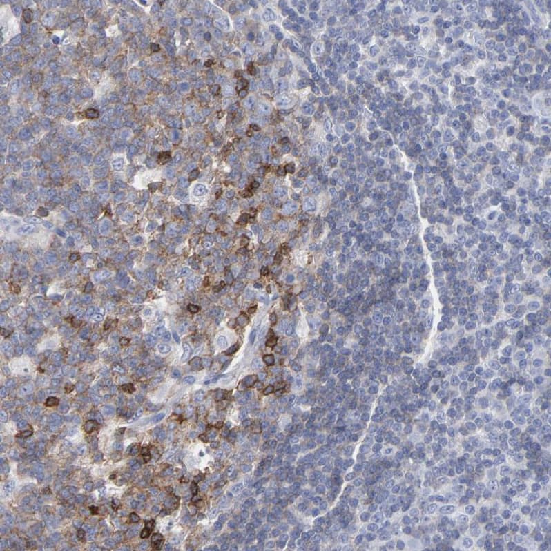 Staining of human tonsil shows strong membranous positivity in germinal center cells.