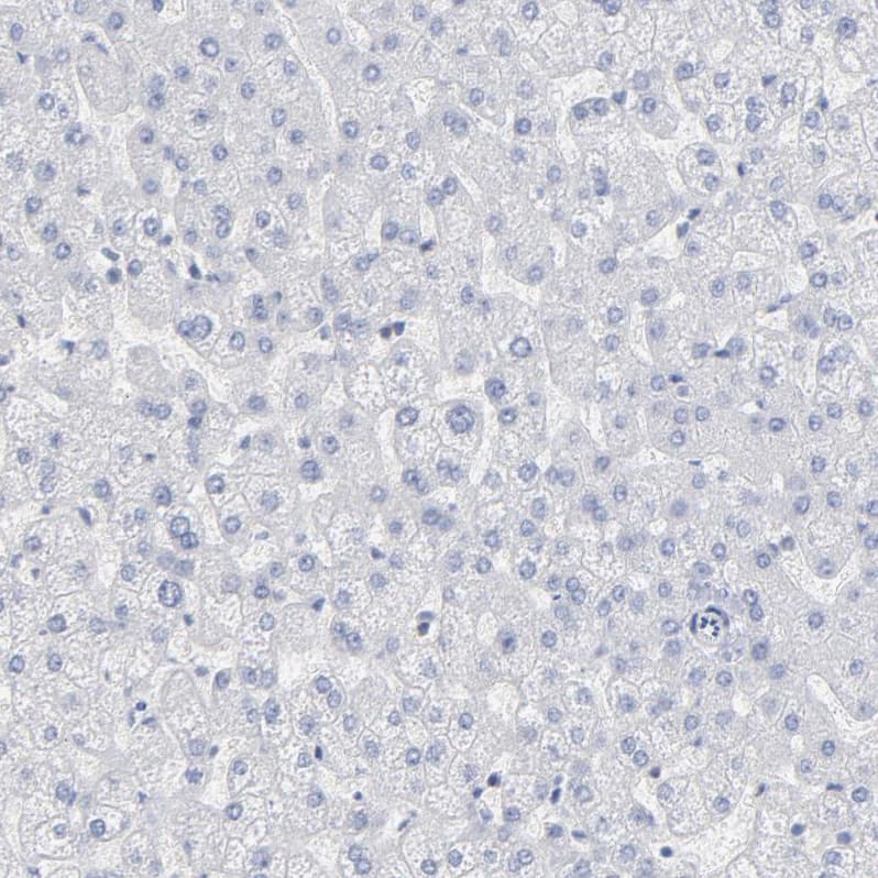 Staining of human liver shows no membranous positivity in hepatocytes as expected.