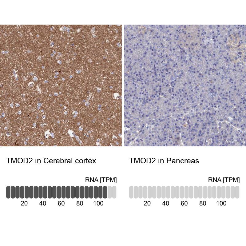 Analysis in human cerebral cortex and pancreas tissues.