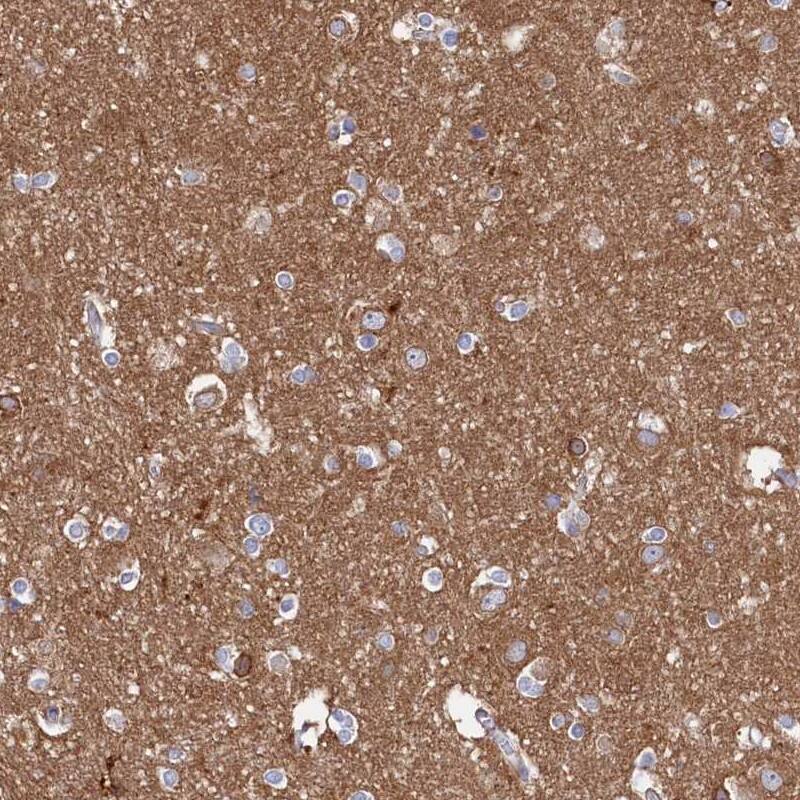 Staining of human cerebral cortex shows high expression.