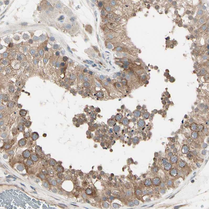 Staining of human testis shows moderate cytoplasmic positivity in cells in seminiferous ducts.