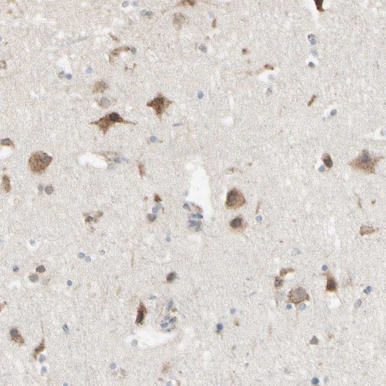 Staining of human cerebral cortex shows moderate cytoplasmic positivity in neurons.