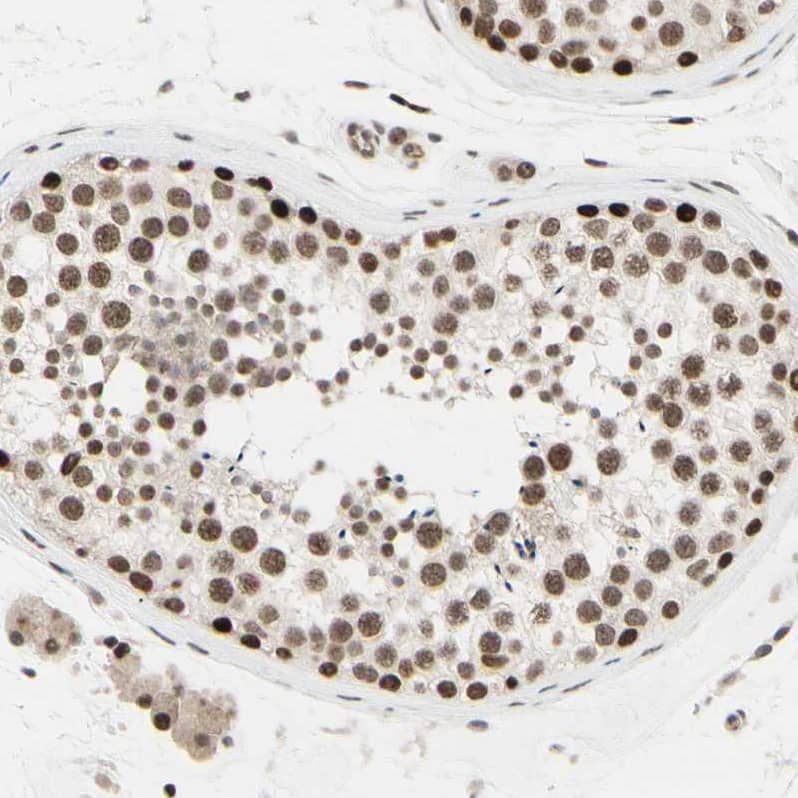 Immunohistochemistry-Paraffin Suppressor of Fused Antibody - BSA Free