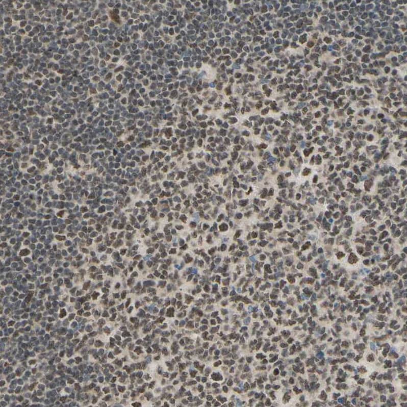 Immunohistochemistry-Paraffin Suppressor of Fused Antibody - BSA Free