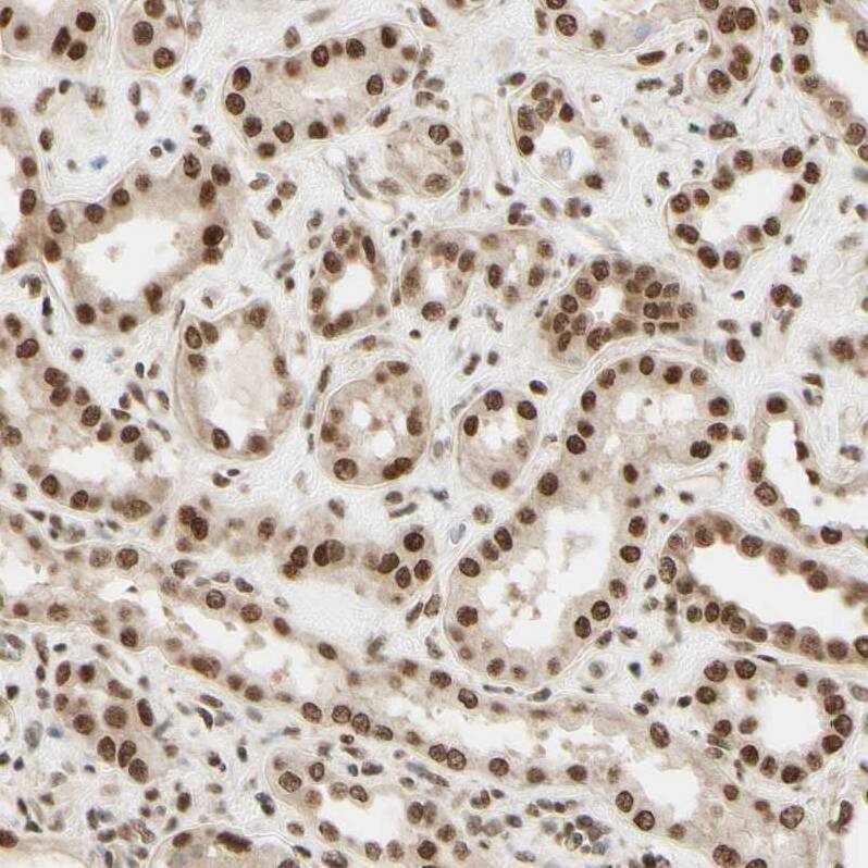 Immunohistochemistry-Paraffin Suppressor of Fused Antibody - BSA Free
