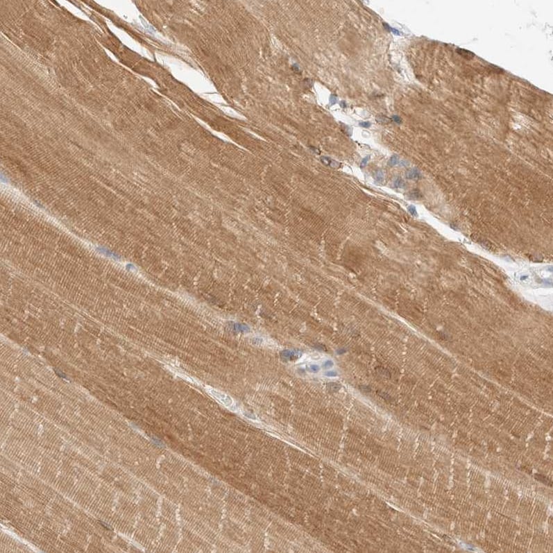 Staining of human skeletal muscle shows moderate cytoplasmic positivity in myocytes.