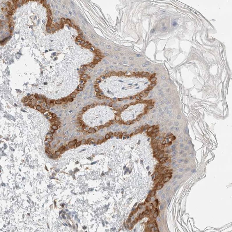 Staining of human skin shows strong cytoplasmic positivity in melanocytes.